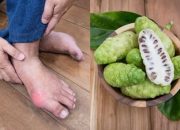 Baru Tahu, Asam Urat Bisa Lenyap Cuma Pakai Buah yang Banyak Tumbuh di Pekarangan Rumah, Lebaran Bakal Sehat Walafiat